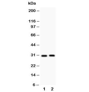 IL-1b Antibody