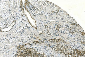 H-Cadherin Antibody / CDH13