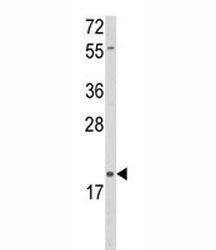 DLK2 Antibody