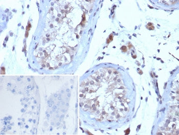 hCG Receptor / LH Receptor Antibody