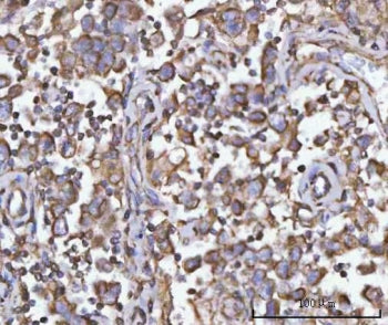 PFKFB1 Antibody / Fructose-2,6-bisphosphatase