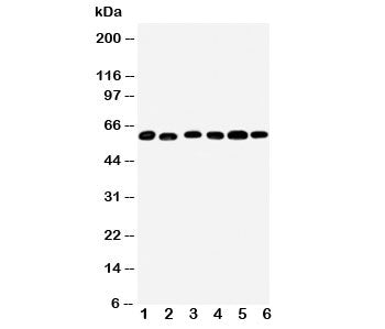 Western blot testing of Monoamine Oxidase B antibody and Lane 1: mouse liver; 2: (m) lung; 3: rat ki
