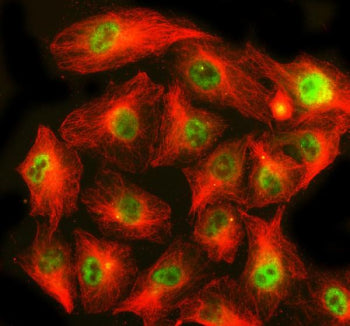 Immunofluorescent staining of CHP1 using anti-CHP1 antibody (green) and anti-Beta Tubulin antibody (