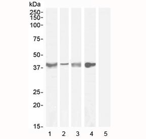 Western blot testing of Asponrin antibody with lysate from 1) human tonsil (Ab at 1ug/ml), 2) human 