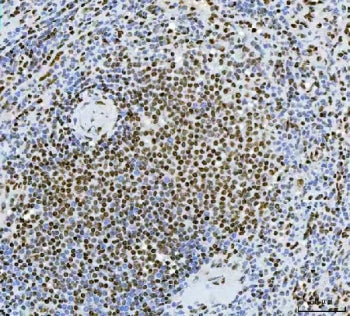 IHC staining of FFPE human spleen tissue with Exonuclease 1 antibody. HIER: boil tissue sections in 