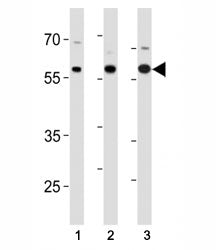 p65 antibody western blot analysis in (1) SK-BR-3, (2) mouse Neuro-2a cell line and (3) mouse testis