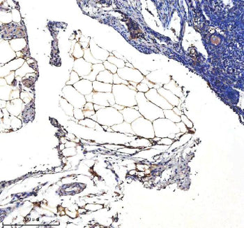 Immunohistochemical staining of SERPINA12 using anti-SERPINA12 antibody. SERPINA12 was detected in a