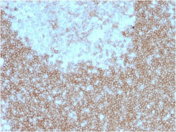 IHC staining of FFPE human tonsil with BAFF Receptor antibody (clone BAFFR/1557). HIER: boil tissue 