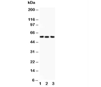 Western blot testing of Alkaline Phosphatase antibody and Lane 1: human placenta; 2: HT1080; 3: Jurk