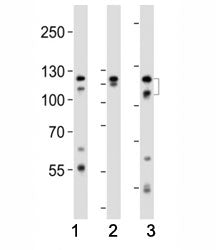 Western blot analysis of lysate from (1) HeLa, (2) K562 and (3) T47D cell line using FGFR2 antibody 