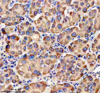 Immunohistochemical staining of TRIM40 using anti-TRIM40 antibody. TRIM40 was detected in a paraffin