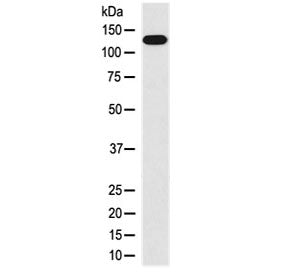 Western blot testing of human HUVEC cell lysate with MLCK antibody at 0.5ug/ml. Predicted molecular 