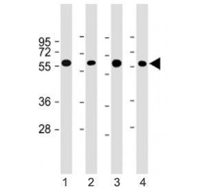 Western blot testing of CRY2 antibody at 1:4000: Lane 1) human HepG2, 2) (h) heart lysate; 3) (h) li
