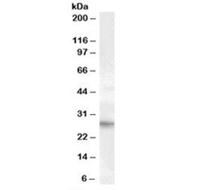 Western blot testing of human heart lysate with PRRX1 antibody at 1ug/ml. Predicted/observed molecul
