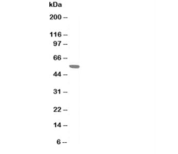 Western blot testing of AChR antibody and rat skeletal muscle tissue lysate