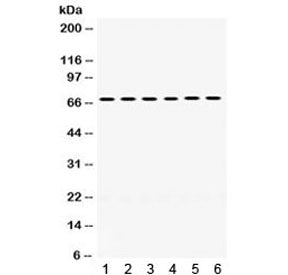 PDPK1 Antibody / 3-phosphoinositide-dependent protein kinase 1