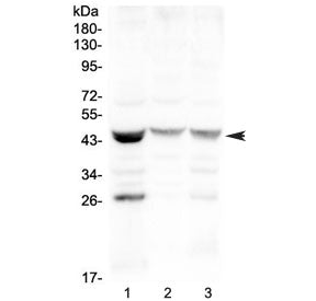 Western blot testing of human 1) MCF7, 2) COLO320 and 3) HepG2 cell lysate with SFTPB antibody at 0.
