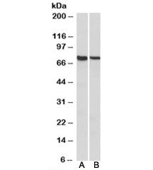 Western blot testing of mouse [A] and rat [B] spleen lysates with MUNC18-3 antibody at 1ug/ml. Predi
