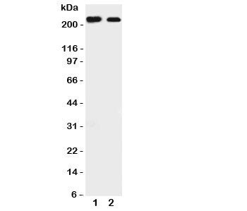 Tuberin Antibody