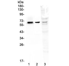 Western blot testing of 1) rat kidney, 2) mouse kidney and 3) human MDA-MB-231 lysate with COBRA1 an