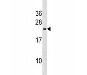 Trem2 antibody western blot analysis in mouse heart tissue lysate. Predicted molecular weight ~25 kD