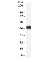 Western blot testing of human heart lysate with CCM2 antibody at 0.03ug/ml. Predicted molecular weig