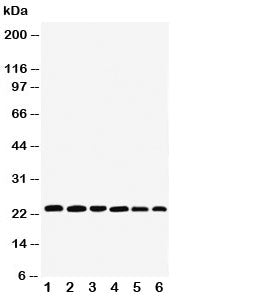 Western blot testing of SNAP23 antibody and Lane 1: rat spleen; 2: (r) testis; 3: (r) ovary; 4: huma