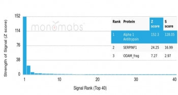 Alpha 1 Antitrypsin Antibody / AAT / SERPINA1