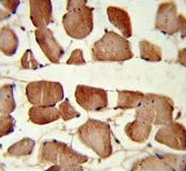 IHC testing of FFPE human skeletal muscle tissue with Aspartoacylase antibody. HIER: steam section i