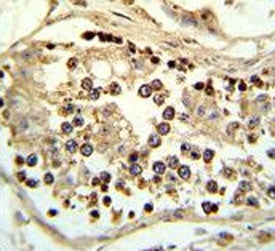 ABHD12 Antibody