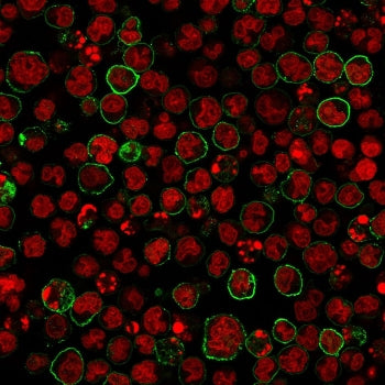 CD20 Antibody