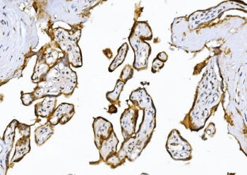IHC staining of FFPE human placental tissue with ADAMTS5 antibody. HIER: boil tissue sections in pH8