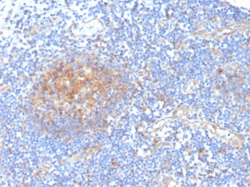 ARK1C1 Antibody / Aldo-keto Reductase Family 1 Member C1