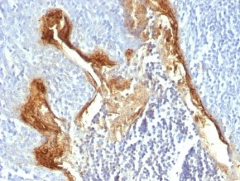 IHC: Formalin-fixed, paraffin-embedded human tonsil stained with Involucrin antibody (clone IVRN/827