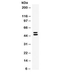 Western blot testing of human A549 cell lysate with EPCR antibody. Expected molecular weight ~24/36-