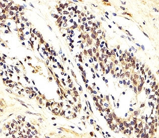 AKT1/2/3 Antibody