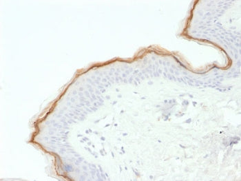IHC testing of FFPE human skin with Filaggrin antibody (clone FLG/1563). Required HIER: boil tissue 