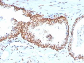 IHC staining of FFPE human prostate with biotinylated recombinant p40 antibody (clone TP40/3980R). H