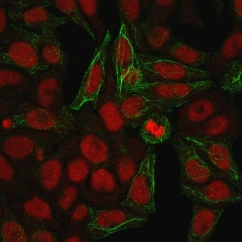 Immunofluorescent staining of methanol fixed human HeLa cells with Cytokeratin 7 antibody (clone KRT