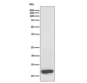 Western blot testing of human plasma lysate with Serum Amyloid A antibody. Predicted molecular weigh