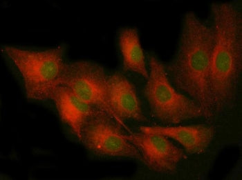 Immunofluorescent staining of FFPE human A549 cells with PKCE antibody (green) and Alpha Tubulin mAb
