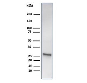 HSP27 Antibody / HSPB1