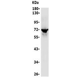Western blot testing of mouse Neuro-2a cell lysate with P2RX7 antibody. Predicted molecular weight ~