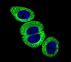 Confocal immunofluorescent analysis of phospho-ATM antibody with HeLa cells followed by Alexa Fluor 