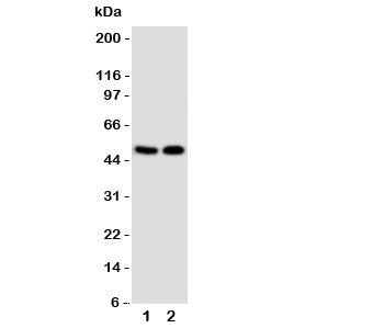 Western blot testing of VDR antibody and Lane 1: MCF-7; 2: HeLa cell lysate. Predicted molecular wei