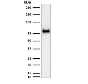Western blot testing of human HeLa cell lysate with CD44 antibody (clone SPM521). Expected molecular