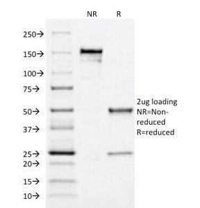 SDS-PAGE Analysis of Purified, BSA-Free MRP1 Antibody (clone MRP1/1344). Confirmation of Integrity a