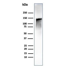 Western blot testing of human ovary tissue lysate using recombinant Caldesmon antibody (clone CALD1/