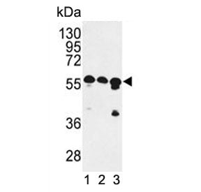 Western blot testing of human 1) MCF7, 2) K562 and 3) HEK293 cell lysate with CCR4-NOT transcription