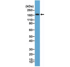 Western blot testing of human brain tissue lysate with recombinant PDGFRB antibody at 1:100. Expecte